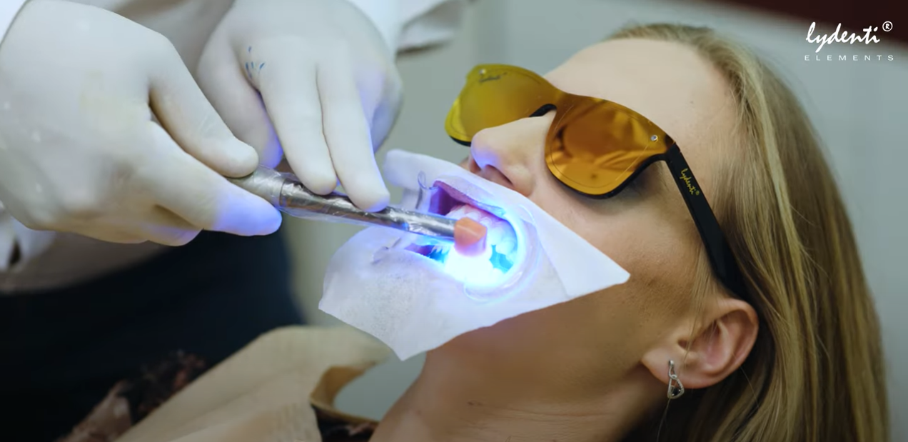 Strahlendes Lächeln: Bleaching für Ihre Zähne